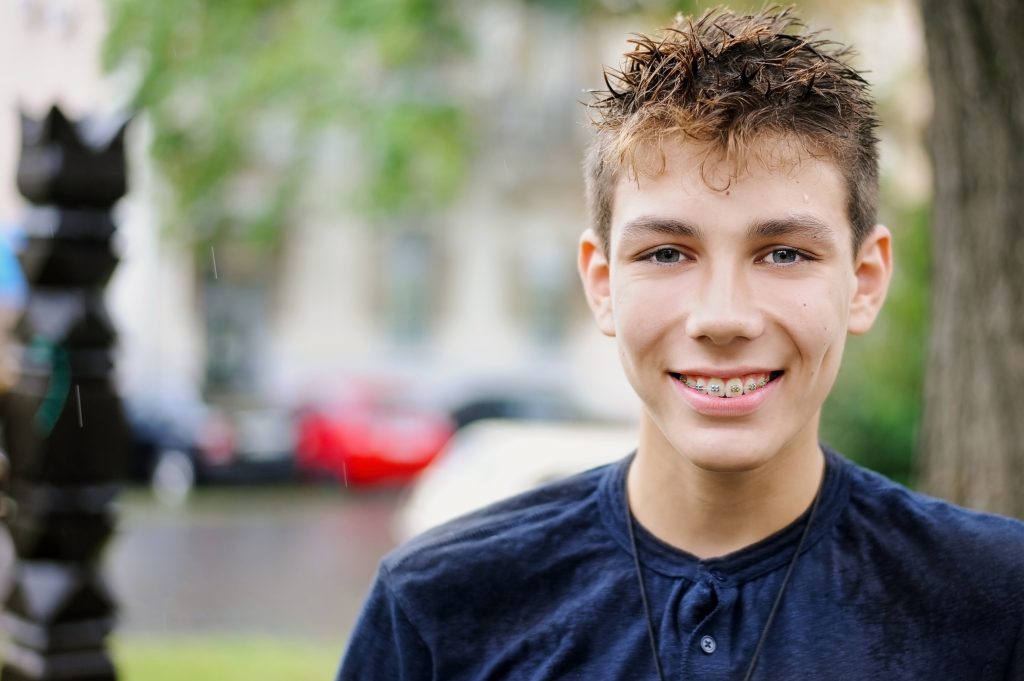 Caring For Braces Ballina SmartSmile Orthodontics